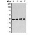 LifeSab™ LDHA Rabbit pAb (50 µl)