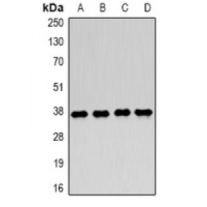 LifeSab™ LDHA Rabbit pAb (50 µl)