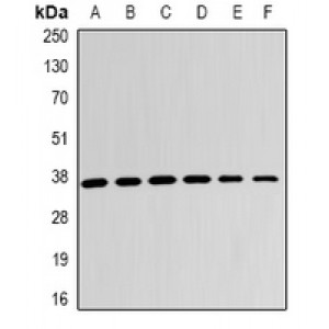 LifeSab™ LDHB Rabbit pAb (50 µl)