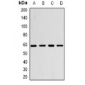 LifeSab™ Monoamine Oxidase B Rabbit pAb (50 µl)