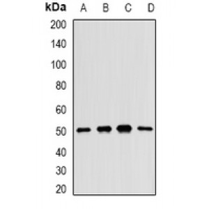 LifeSab™ MKK5 Rabbit pAb (50 µl)