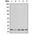 LifeSab™ COX2 Rabbit pAb (50 µl)