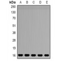 LifeSab™ NDUFB5 Rabbit pAb (50 µl)