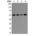 LifeSab™ Ornithine Decarboxylase Rabbit pAb (50 µl)