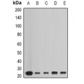 LifeSab™ Peroxiredoxin 1 Rabbit pAb (50 µl)