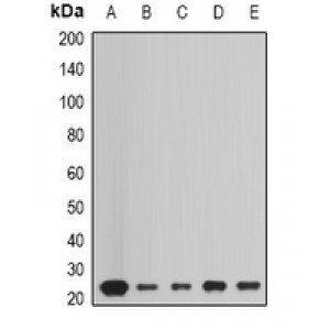 LifeSab™ Peroxiredoxin 1 Rabbit pAb (50 µl)