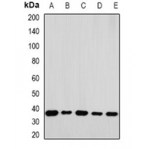 LifeSab™ RPLP0 Rabbit pAb (50 µl)