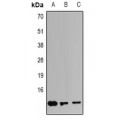 LifeSab™ S100-A4 Rabbit pAb (50 µl)