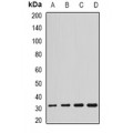 LifeSab™ SCO2 Rabbit pAb (50 µl)