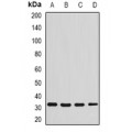 LifeSab™ Syntenin Rabbit pAb (50 µl)