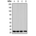 LifeSab™ SOD2 Rabbit pAb (50 µl)