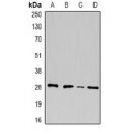 LifeSab™ U2AF1 Rabbit pAb (50 µl)
