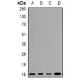 LifeSab™ UBCH7 Rabbit pAb (50 µl)