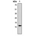 LifeSab™ FGF1 Rabbit pAb (50 µl)