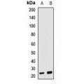 LifeSab™ Neurotrophin 4 Rabbit pAb (50 µl)