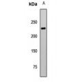 LifeSab™ TET1 Rabbit pAb (50 µl)