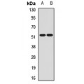 LifeSab™ CHRM2 Rabbit pAb (50 µl)