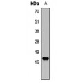 LifeSab™ ANP Rabbit pAb (50 µl)