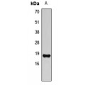 LifeSab™ ACP1 Rabbit pAb (50 µl)