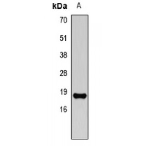 LifeSab™ ACP1 Rabbit pAb (50 µl)