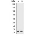 LifeSab™ Syndecan 2 Rabbit pAb (50 µl)