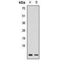 LifeSab™ Rbx1 Rabbit pAb (50 µl)