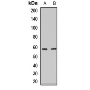 LifeSab™ Endothelial Lipase Rabbit pAb (50 µl)