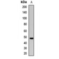 LifeSab™ TMPase Rabbit pAb (50 µl)