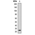 LifeSab™ APCS Rabbit pAb (50 µl)
