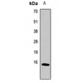 LifeSab™ Metallothionein-2A Rabbit pAb (50 µl)