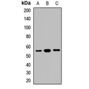 LifeSab™ GPT Rabbit pAb (50 µl)