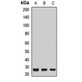 LifeSab™ ATP6V1E1 Rabbit pAb (50 µl)