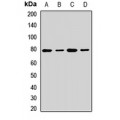 LifeSab™ GFAT Rabbit pAb (50 µl)
