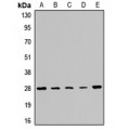 LifeSab™ PMM2 Rabbit pAb (50 µl)