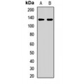 LifeSab™ SAF-B2 Rabbit pAb (50 µl)