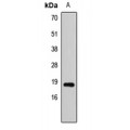 LifeSab™ SAP18 Rabbit pAb (50 µl)