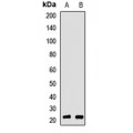 LifeSab™ RBBP9 Rabbit pAb (50 µl)