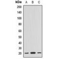 LifeSab™ BLOC1S6 Rabbit pAb (50 µl)