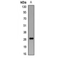 LifeSab™ Collectin 11 Rabbit pAb (50 µl)