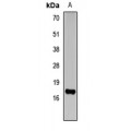 LifeSab™ Histone H3 (TriMethyl K14) Rabbit pAb (50 µl)