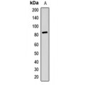 LifeSab™ RSK2 Rabbit pAb (50 µl)