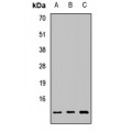 LifeSab™ MGP Rabbit pAb (50 µl)