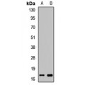 LifeSab™ Myoglobin Rabbit pAb (50 µl)
