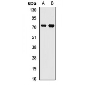 LifeSab™ FMR1 Rabbit pAb (50 µl)