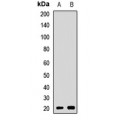 LifeSab™ CSRP3 Rabbit pAb (50 µl)