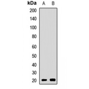 LifeSab™ CSRP3 Rabbit pAb (50 µl)