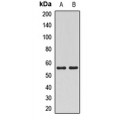 LifeSab™ MATK Rabbit pAb (50 µl)