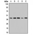 LifeSab™ RAMP3 Rabbit pAb (50 µl)