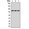 LifeSab™ TLK2 Rabbit pAb (50 µl)