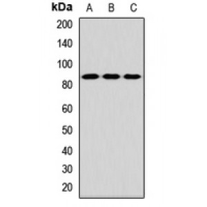 LifeSab™ TLK2 Rabbit pAb (50 µl)